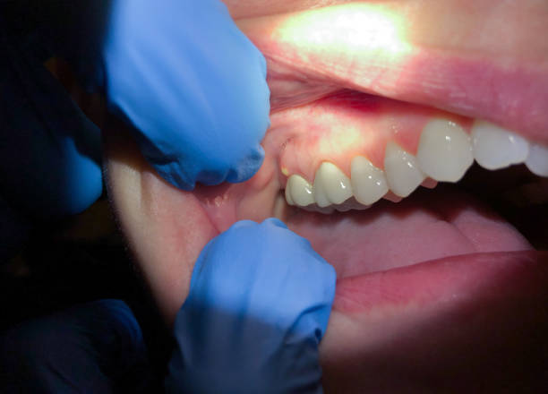 Best Emergency Cosmetic Dentistry (e.g., broken veneers) in North Las Vegas, NV