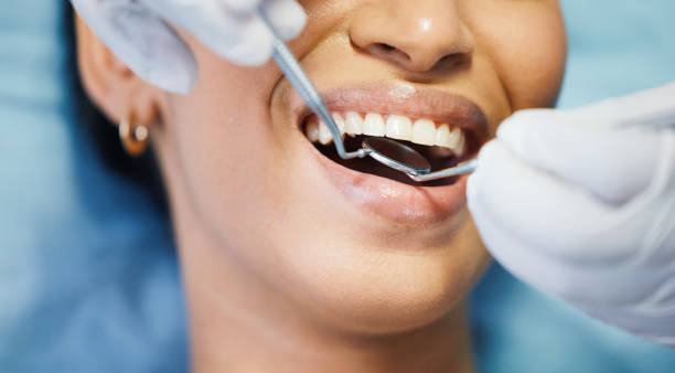 Best Lost Filling or Crown Replacement in North Las Vegas, NV